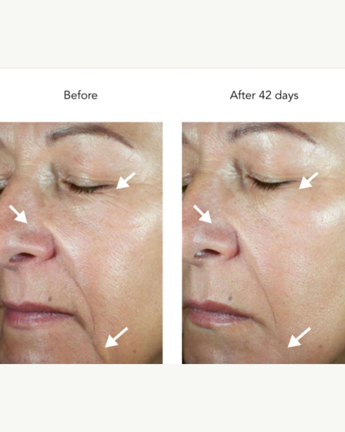 DNA-42 Clinicalift Serum