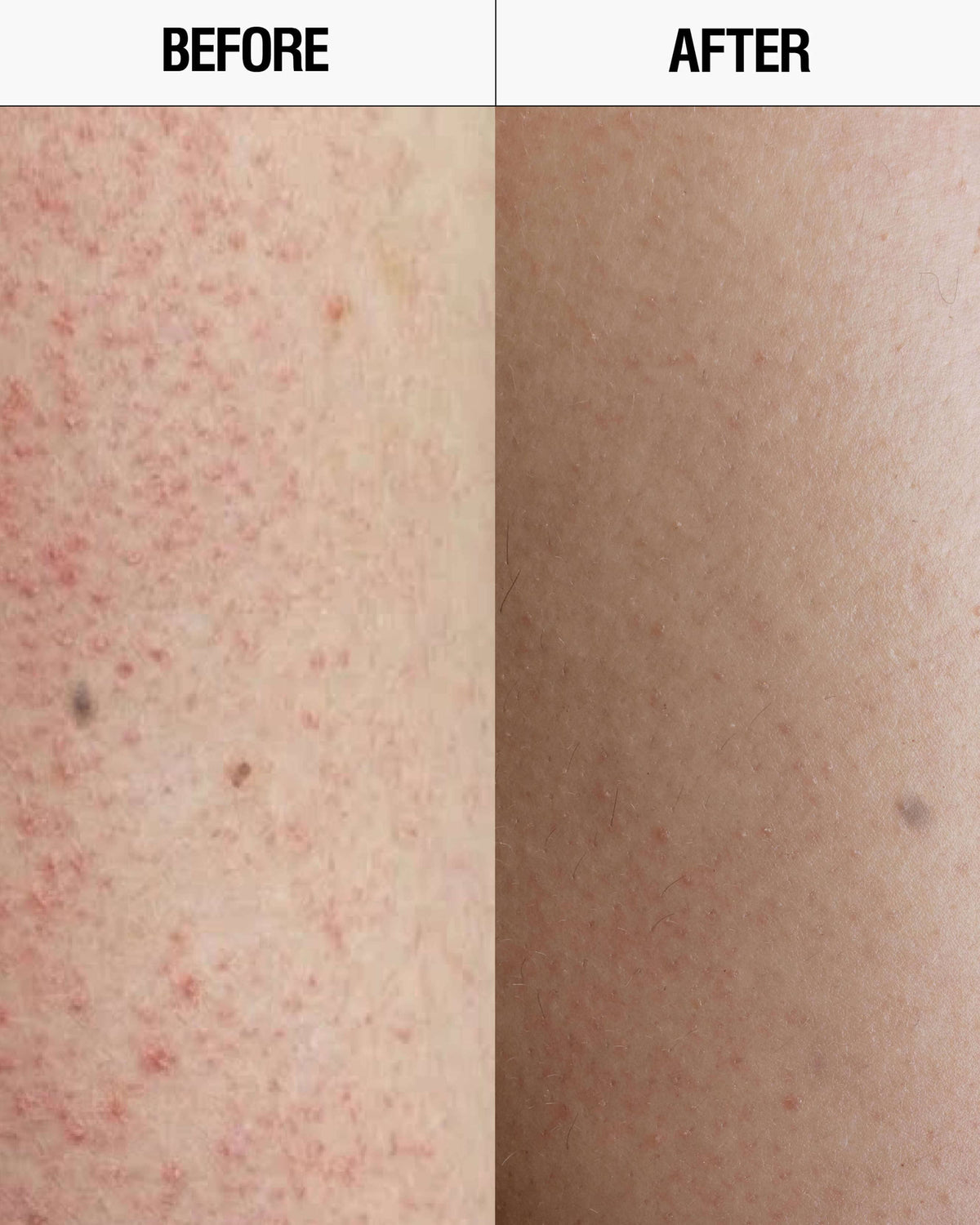 Resurfacing Targeted Body Cleanser