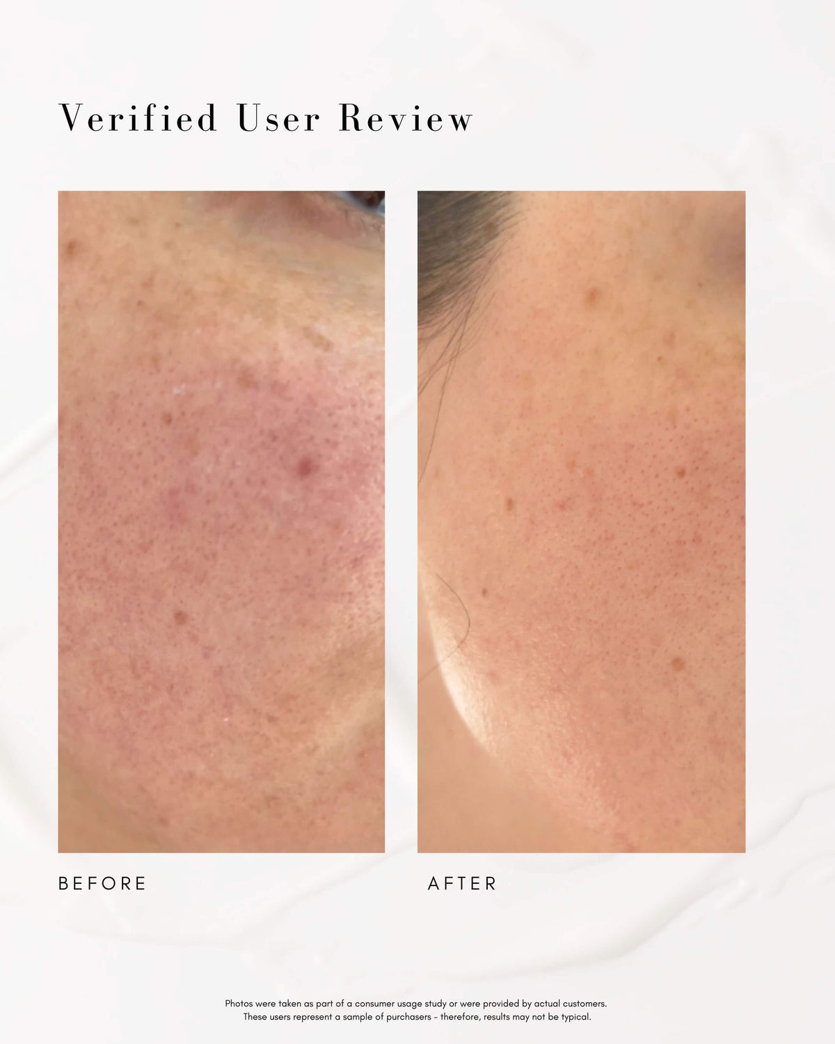 The Super Lift Vitamin C-More Treatment