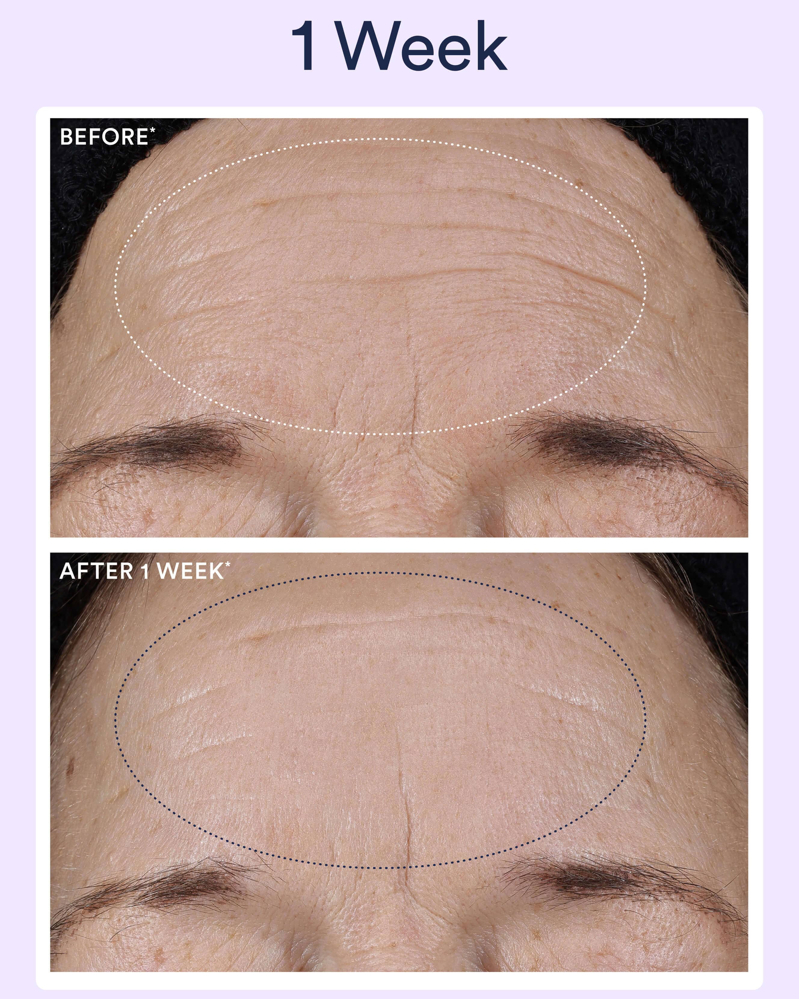 Dream Night Serum with Bio-Retinol