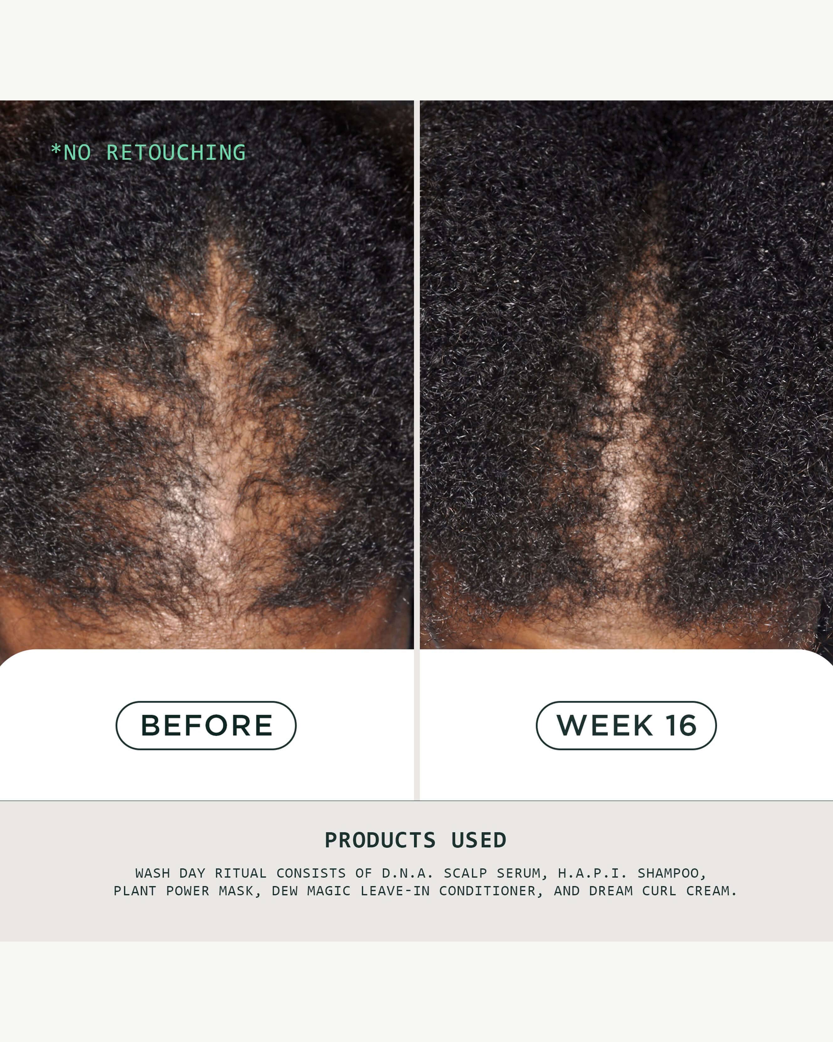 DNA Scalp Serum