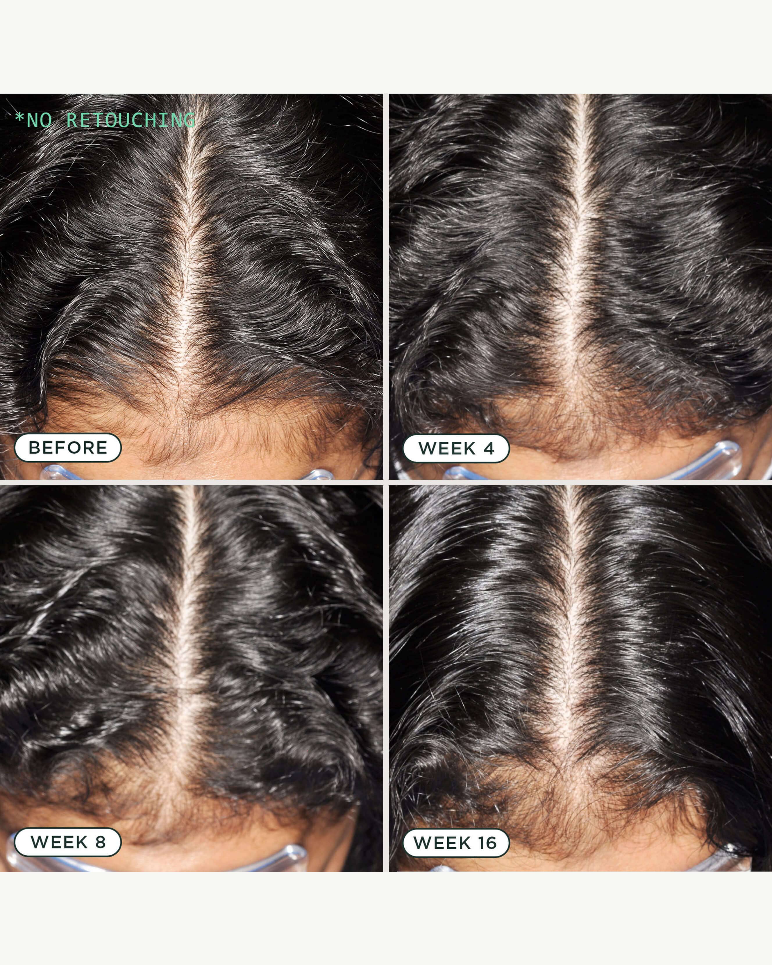 DNA Scalp Serum