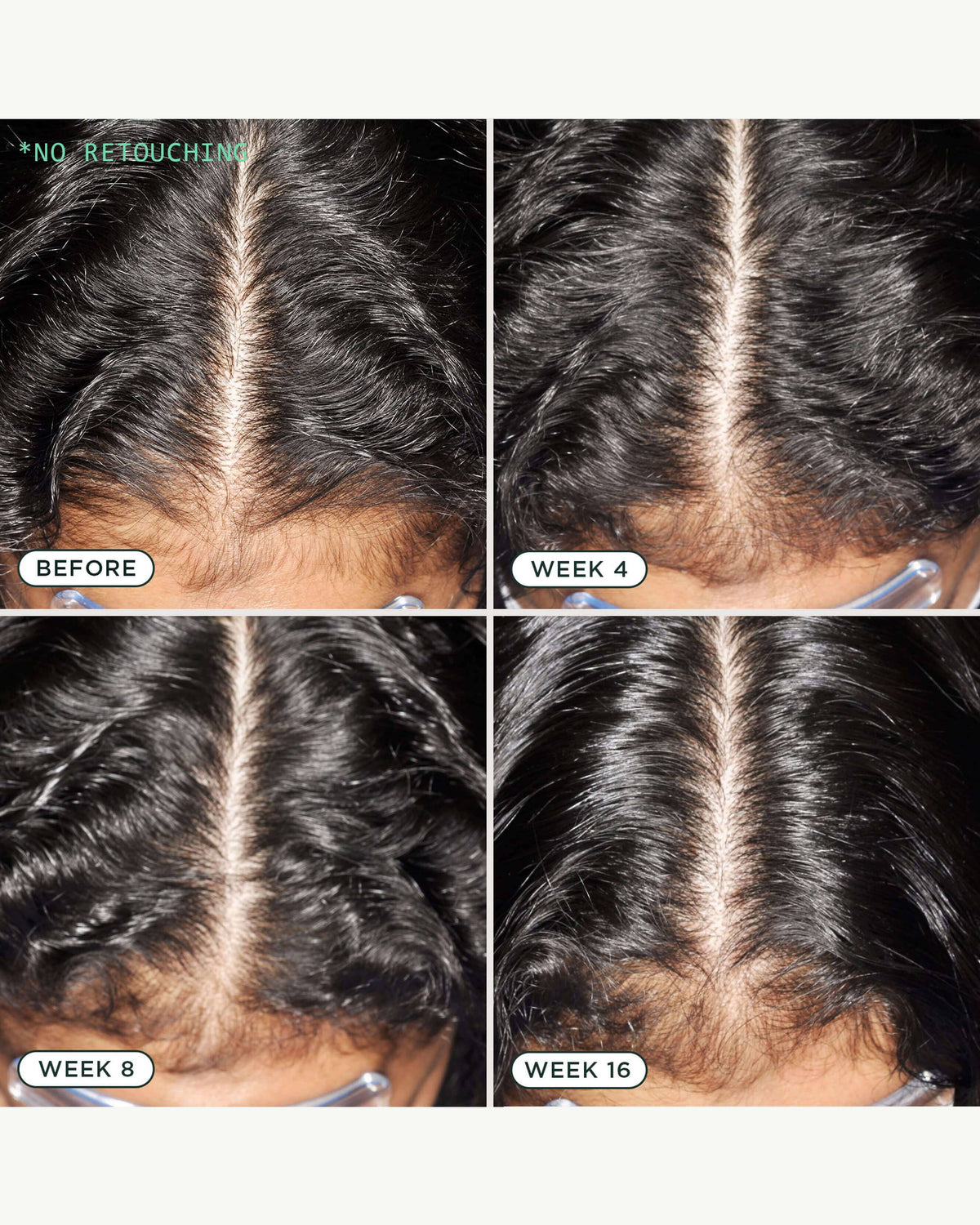 DNA Scalp Serum