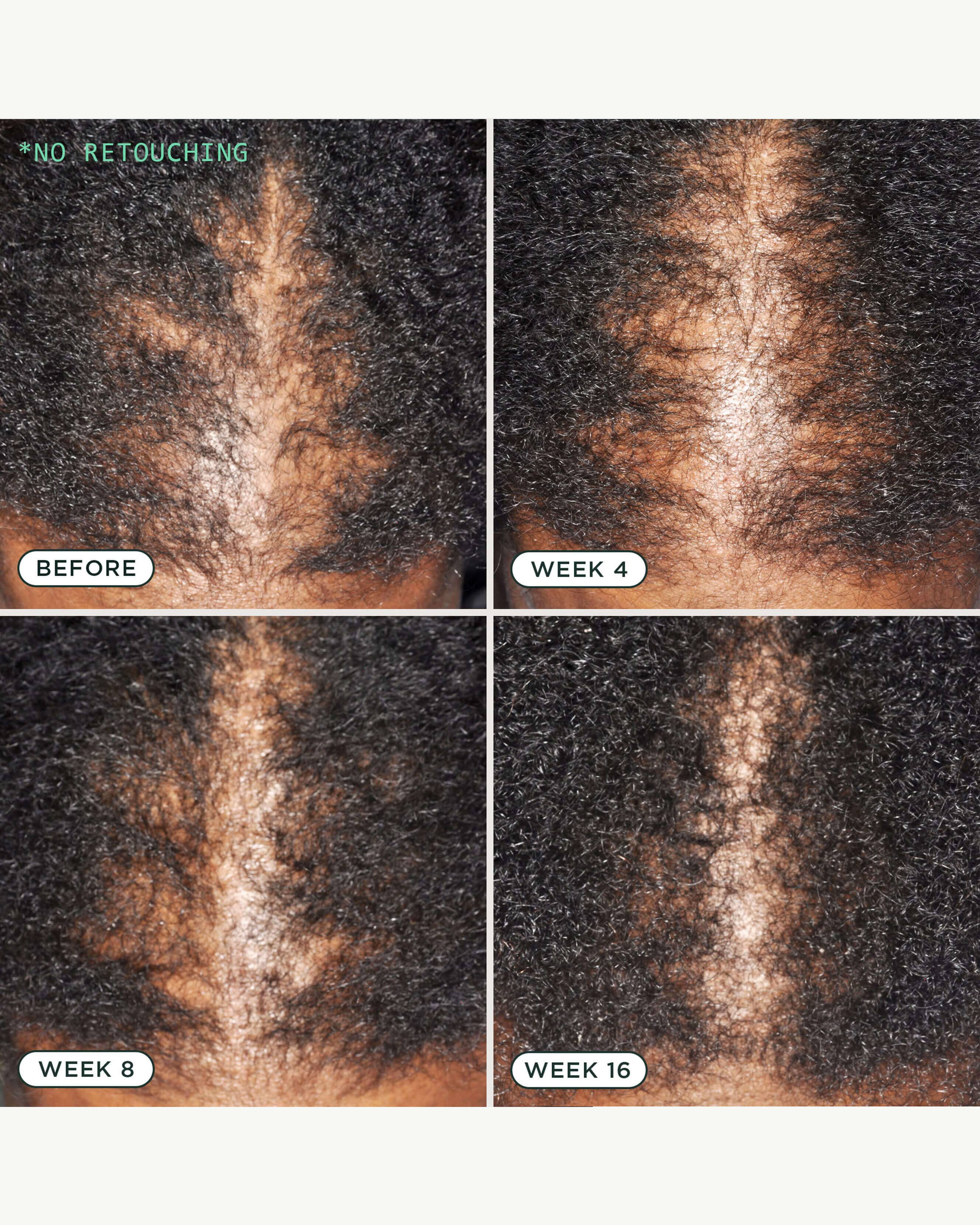 DNA Scalp Serum