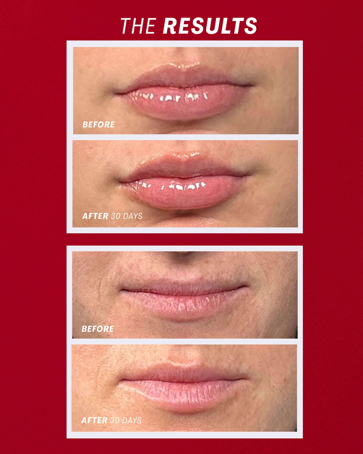 Sun Kiss (Red)