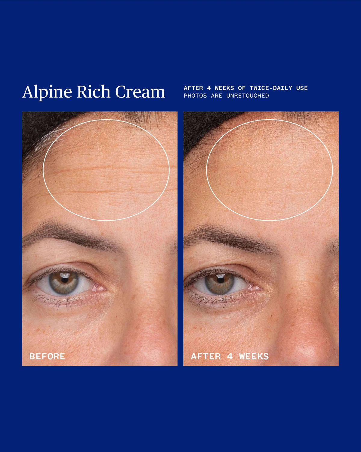 Alpine Rich Cream Barrier Moisturizer for Dry & Sensitive Skin