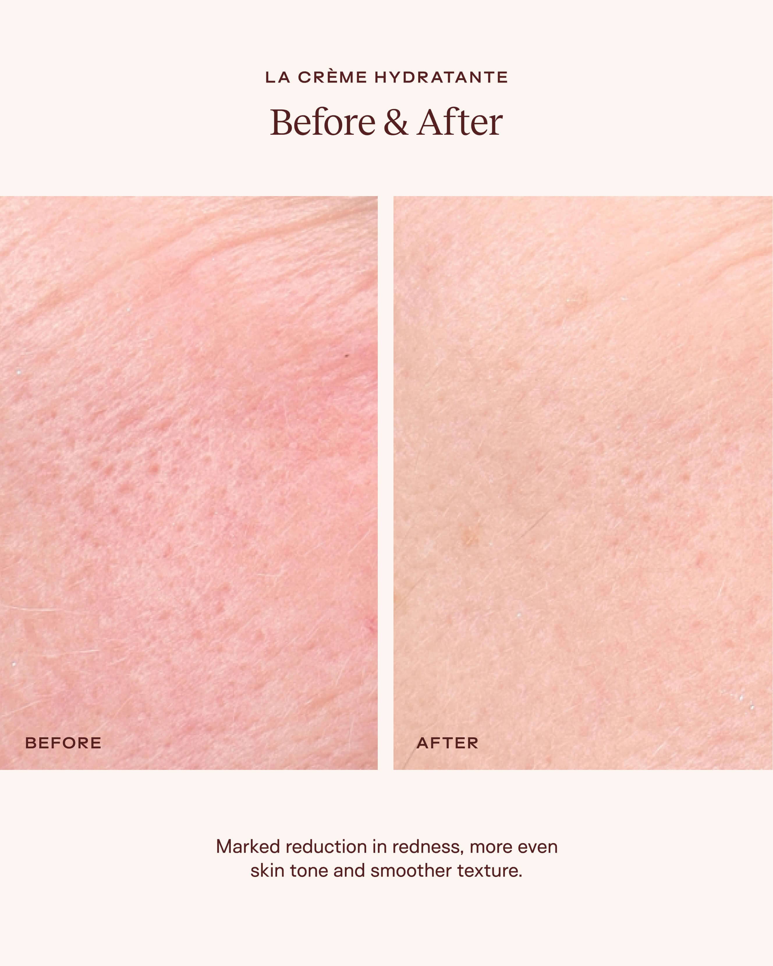 La Crème Hydratante – Beta-Glucan Mushroom Moisturizer