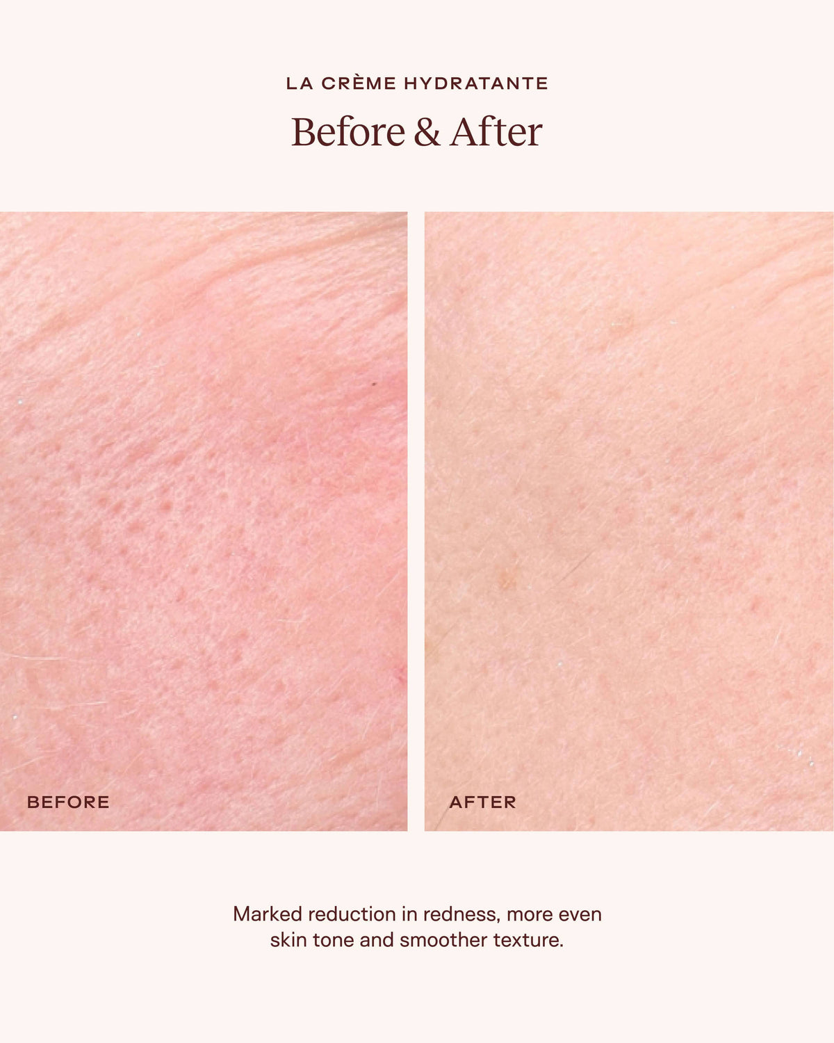 La Crème Hydratante – Beta-Glucan Mushroom Moisturizer
